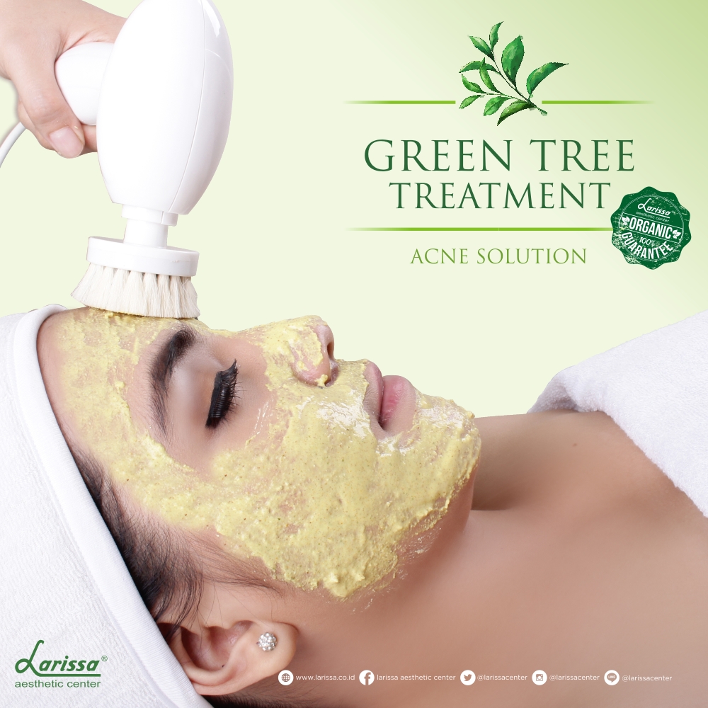 Treatment Jerawat Green Tea Facial Larissa Tampilkan Wajah 